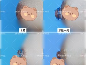 十四岁女孩乳房就特别大正常吗？不用担心，试试[产品名称]，让你健康自信