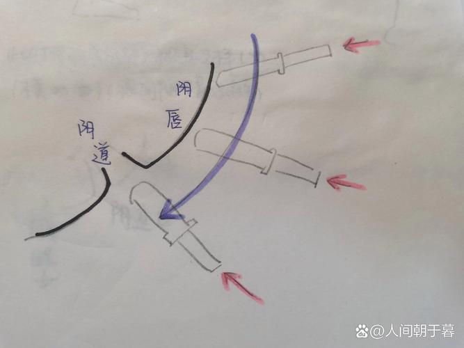 新手如何找到入口准确位置?
